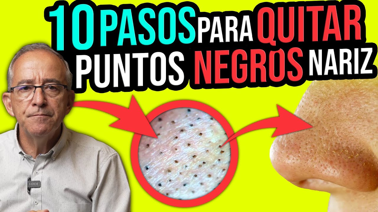 que sirve para quitar los puntos negro de la nariz