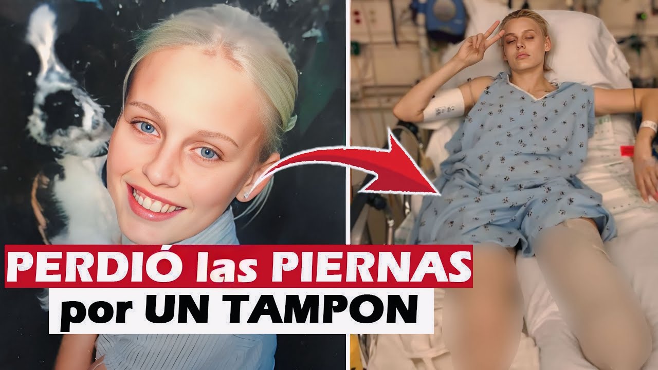 el caso de la modelo de las piernas bonitas